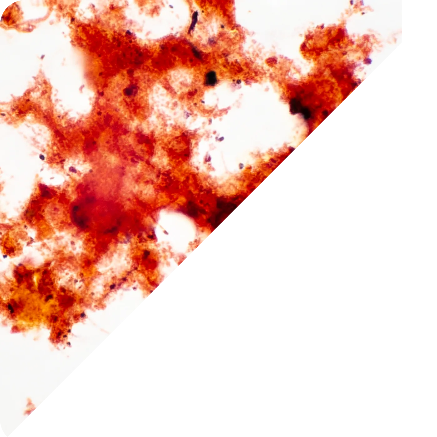 Mikroskopický snímok kalu po aplikácii – zlepšená štruktúra